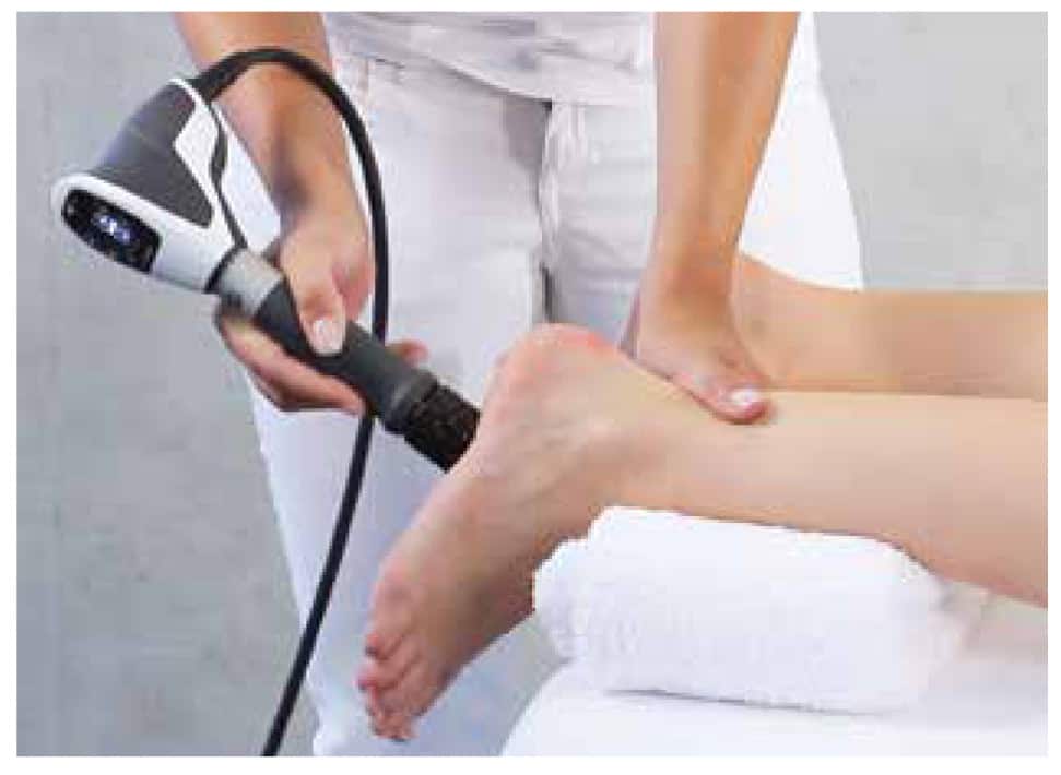 EPAT shockwave therapy for tennis elbow at Trinity Rehab