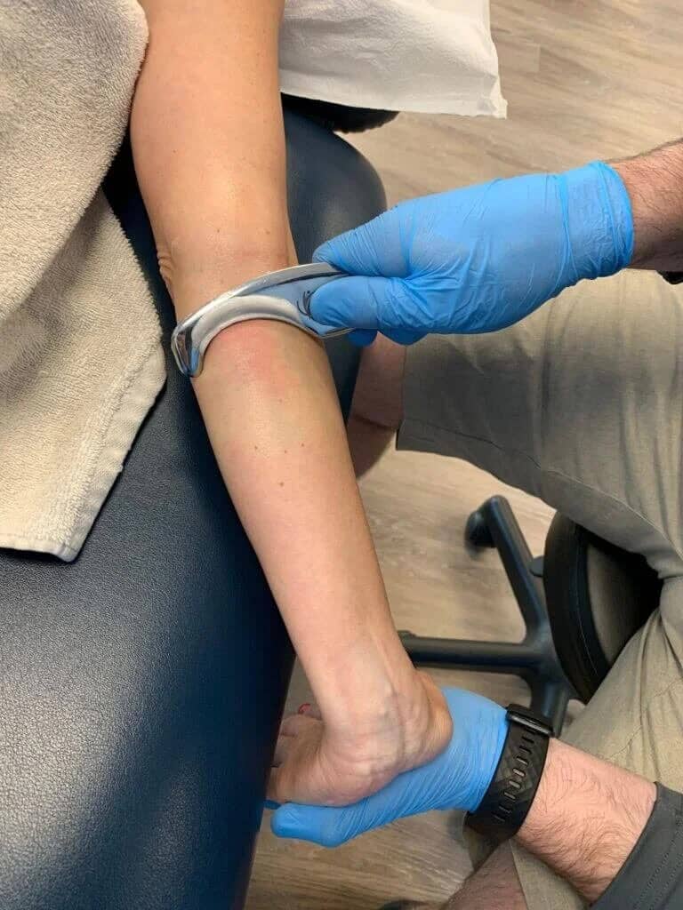 Manual therapy and soft tissue mobilization for golfer's elbow