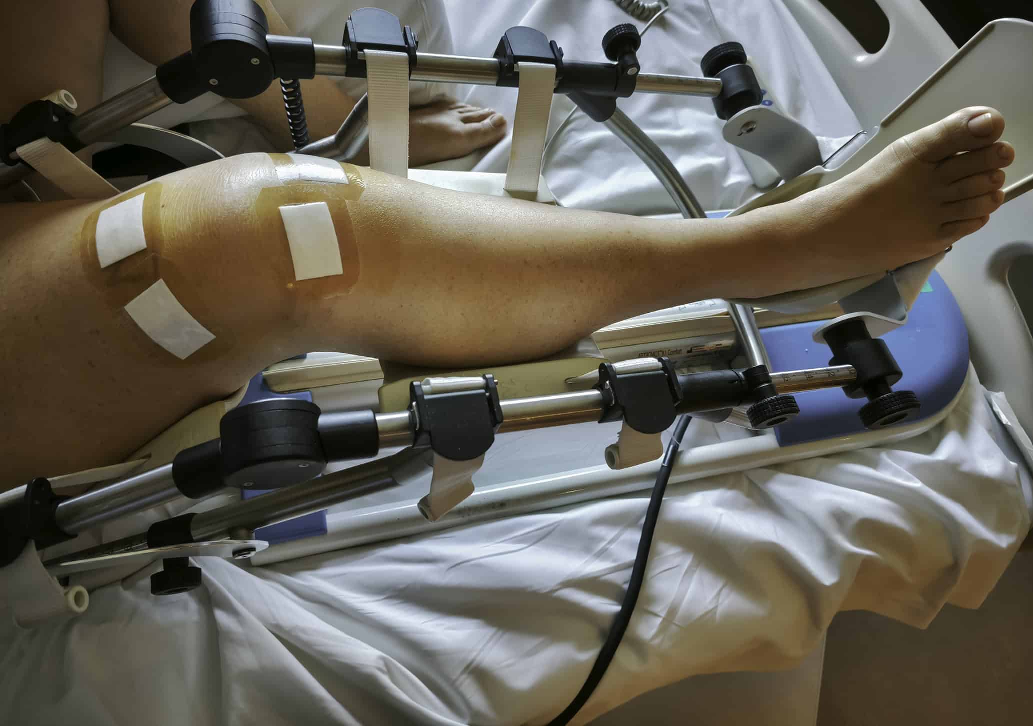 Post-operative knee rehabilitation with CPM device at Trinity Rehab